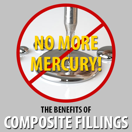 Composite Fillings